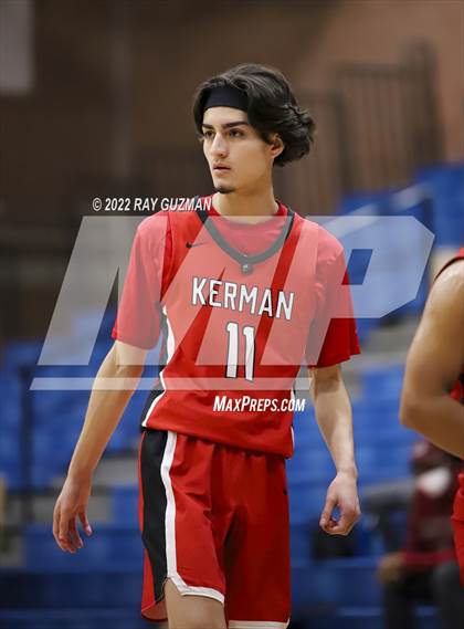 Thumbnail 1 in Redwood vs. Kerman photogallery.