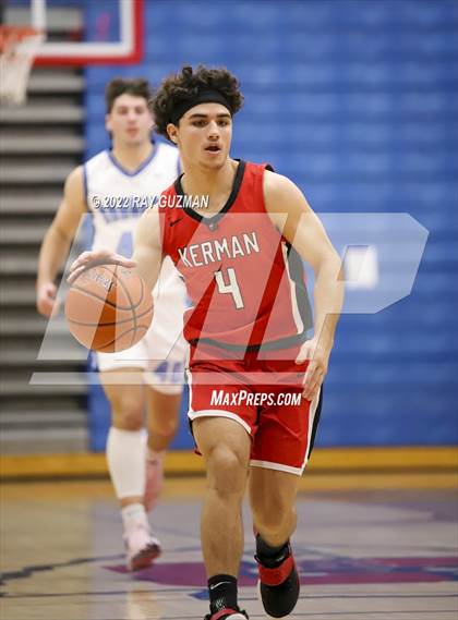 Thumbnail 1 in Redwood vs. Kerman photogallery.