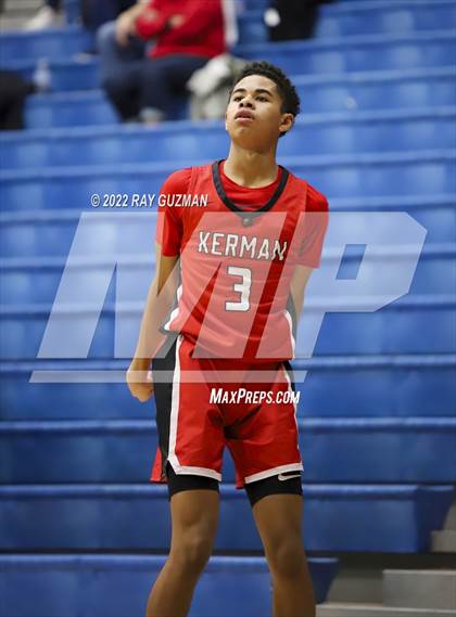 Thumbnail 3 in Redwood vs. Kerman photogallery.