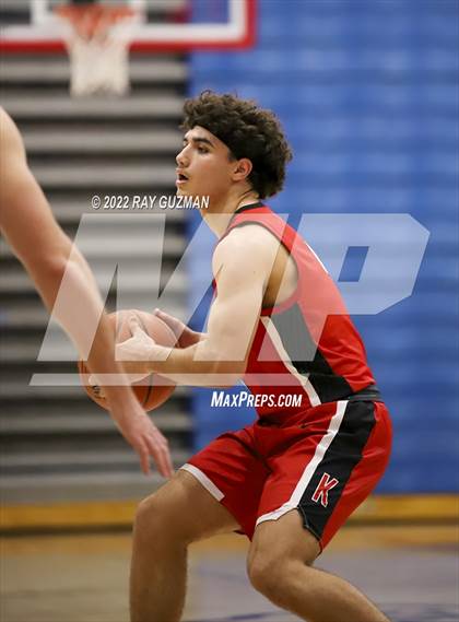Thumbnail 3 in Redwood vs. Kerman photogallery.