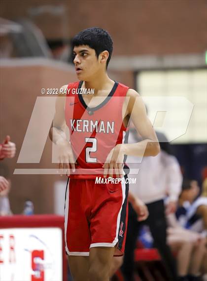 Thumbnail 1 in Redwood vs. Kerman photogallery.
