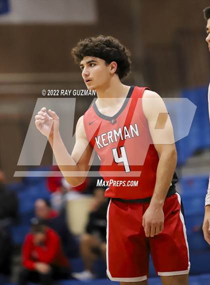 Thumbnail 3 in Redwood vs. Kerman photogallery.