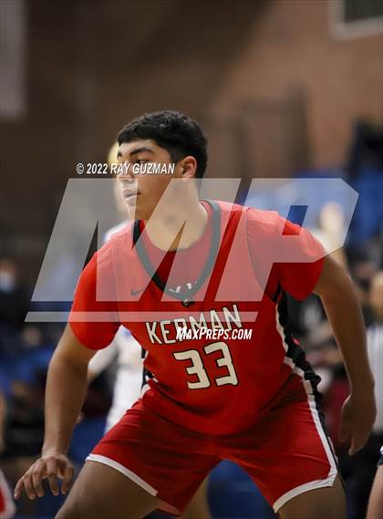 Thumbnail 1 in Redwood vs. Kerman photogallery.