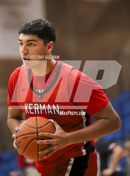 Thumbnail 1 in Redwood vs. Kerman photogallery.