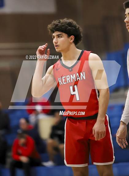 Thumbnail 1 in Redwood vs. Kerman photogallery.