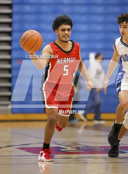 Thumbnail 3 in Redwood vs. Kerman photogallery.