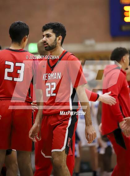 Thumbnail 2 in Redwood vs. Kerman photogallery.