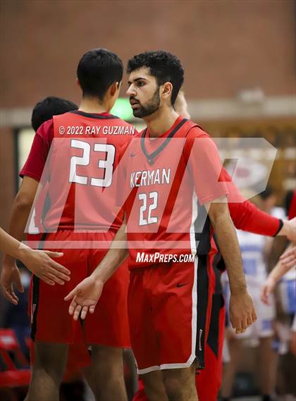 Thumbnail 3 in Redwood vs. Kerman photogallery.