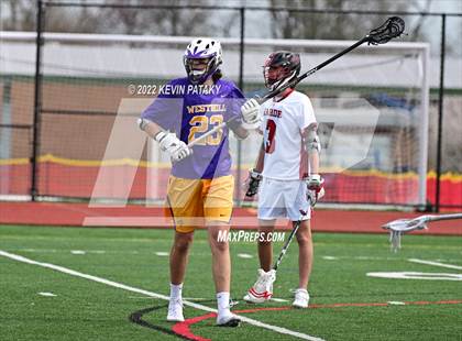 Thumbnail 2 in Westhill @ Fairfield Warde photogallery.