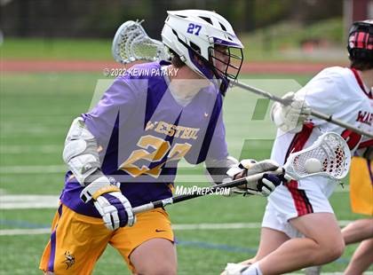 Thumbnail 1 in Westhill @ Fairfield Warde photogallery.