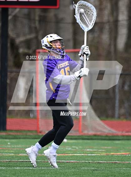Thumbnail 2 in Westhill @ Fairfield Warde photogallery.