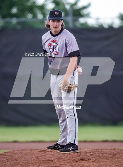Thumbnail 2 in Prairie @ Bettendorf photogallery.