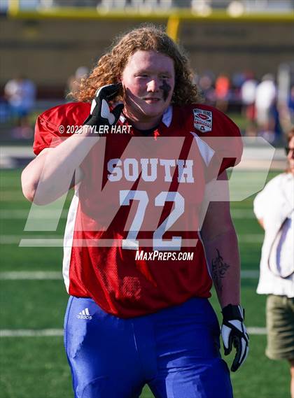 Thumbnail 2 in Murat Shrine North/South All Start Football Classic photogallery.