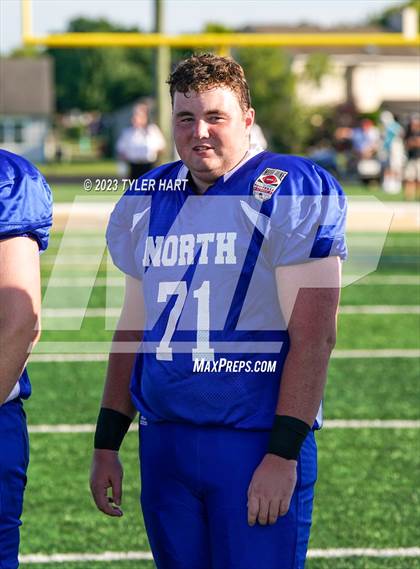 Thumbnail 3 in Murat Shrine North/South All Start Football Classic photogallery.