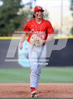 Photo from the gallery "Corona vs. Santiago"