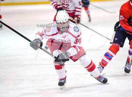 Thumbnail 2 in High Point @ Bernards (Charette Cup Final) photogallery.