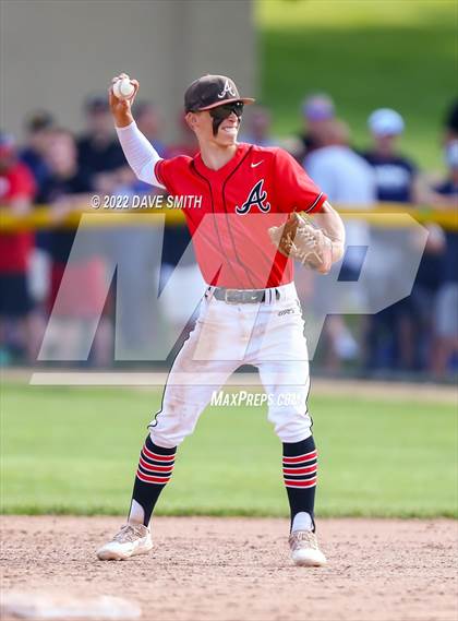 Thumbnail 2 in Pleasant Valley @ Assumption photogallery.