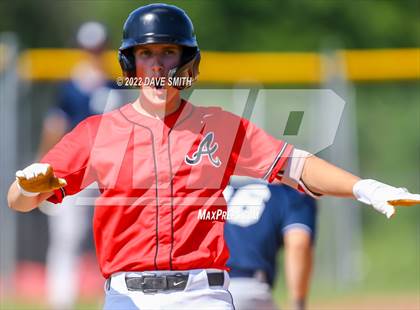Thumbnail 3 in Pleasant Valley @ Assumption photogallery.