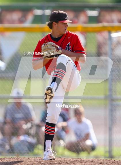 Thumbnail 1 in Pleasant Valley @ Assumption photogallery.
