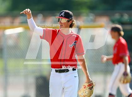 Thumbnail 1 in Pleasant Valley @ Assumption photogallery.