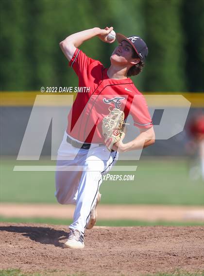 Thumbnail 3 in Pleasant Valley @ Assumption photogallery.