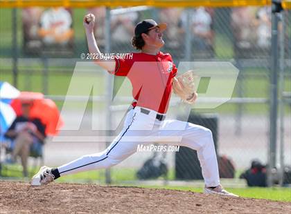 Thumbnail 3 in Pleasant Valley @ Assumption photogallery.