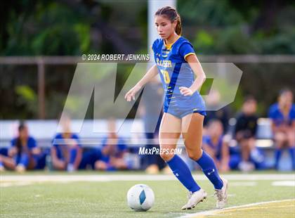 Thumbnail 3 in Kahuku @ Kaiser photogallery.