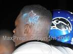 Armwood