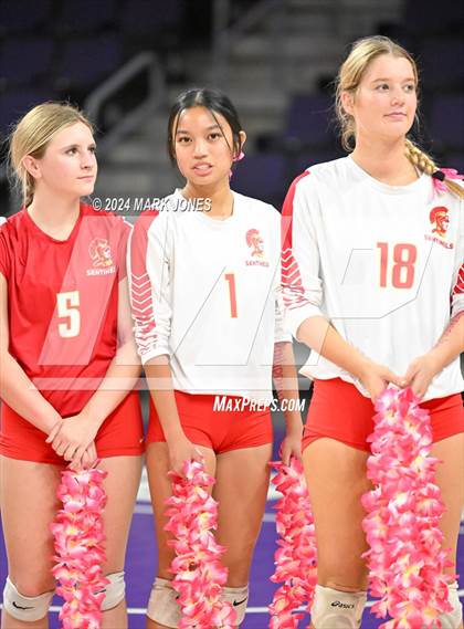 Thumbnail 3 in Seton Catholic @ Valley Christian (Dig for a Cure) photogallery.