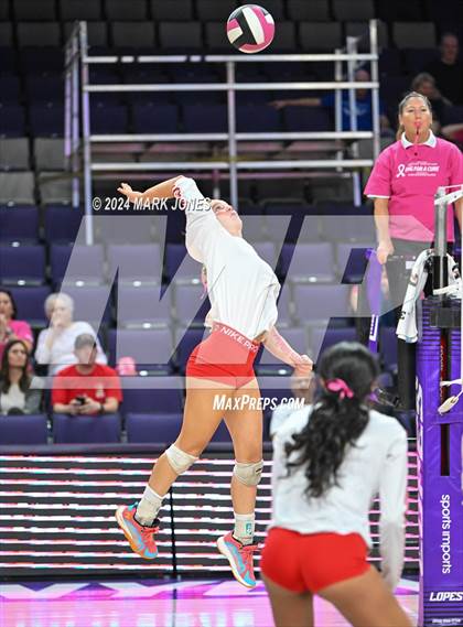 Thumbnail 1 in Seton Catholic @ Valley Christian (Dig for a Cure) photogallery.