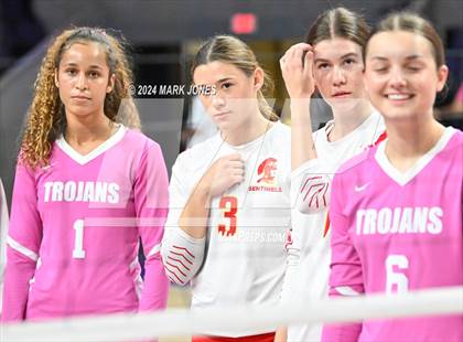 Thumbnail 3 in Seton Catholic @ Valley Christian (Dig for a Cure) photogallery.