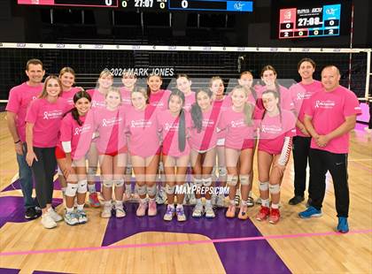 Thumbnail 3 in Seton Catholic @ Valley Christian (Dig for a Cure) photogallery.