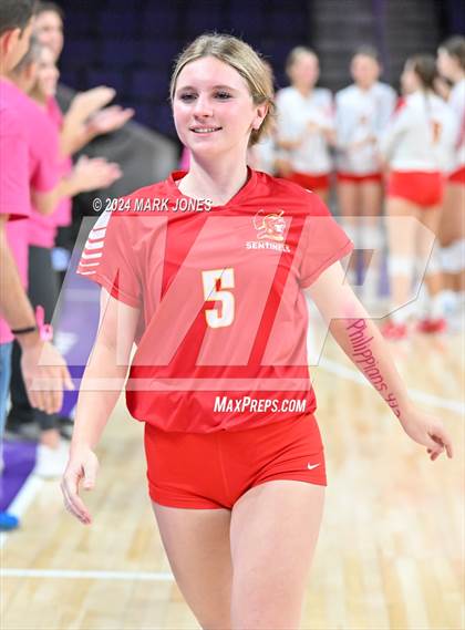 Thumbnail 2 in Seton Catholic @ Valley Christian (Dig for a Cure) photogallery.
