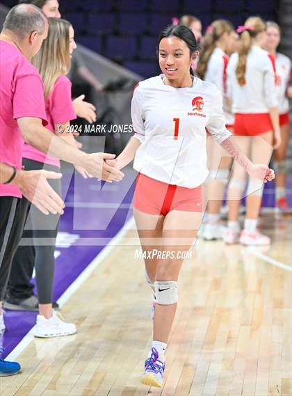 Thumbnail 2 in Seton Catholic @ Valley Christian (Dig for a Cure) photogallery.