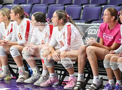 Thumbnail 2 in Seton Catholic @ Valley Christian (Dig for a Cure) photogallery.