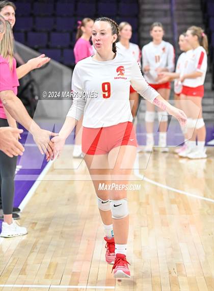 Thumbnail 1 in Seton Catholic @ Valley Christian (Dig for a Cure) photogallery.
