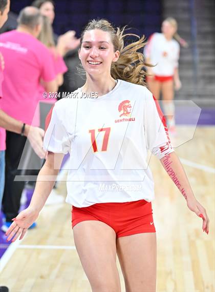 Thumbnail 3 in Seton Catholic @ Valley Christian (Dig for a Cure) photogallery.