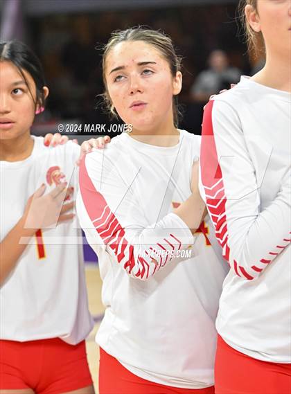 Thumbnail 3 in Seton Catholic @ Valley Christian (Dig for a Cure) photogallery.