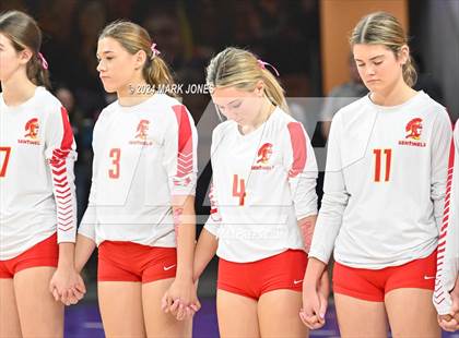 Thumbnail 2 in Seton Catholic @ Valley Christian (Dig for a Cure) photogallery.