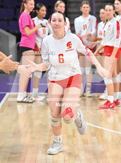 Thumbnail 3 in Seton Catholic @ Valley Christian (Dig for a Cure) photogallery.