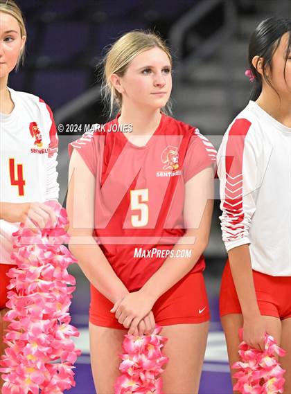 Thumbnail 2 in Seton Catholic @ Valley Christian (Dig for a Cure) photogallery.