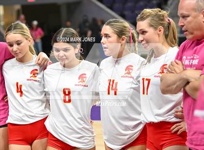 Thumbnail 2 in Seton Catholic @ Valley Christian (Dig for a Cure) photogallery.