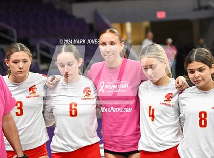 Thumbnail 3 in Seton Catholic @ Valley Christian (Dig for a Cure) photogallery.