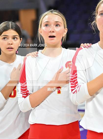 Thumbnail 2 in Seton Catholic @ Valley Christian (Dig for a Cure) photogallery.