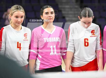 Thumbnail 2 in Seton Catholic @ Valley Christian (Dig for a Cure) photogallery.