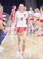 Photo from the gallery "Seton Catholic @ Valley Christian (Dig for a Cure)"