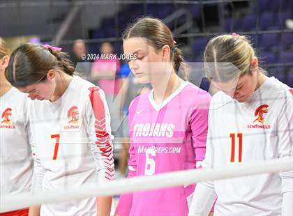 Thumbnail 1 in Seton Catholic @ Valley Christian (Dig for a Cure) photogallery.