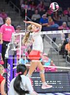 Photo from the gallery "Seton Catholic @ Valley Christian (Dig for a Cure)"