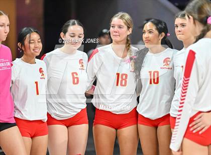 Thumbnail 3 in Seton Catholic @ Valley Christian (Dig for a Cure) photogallery.