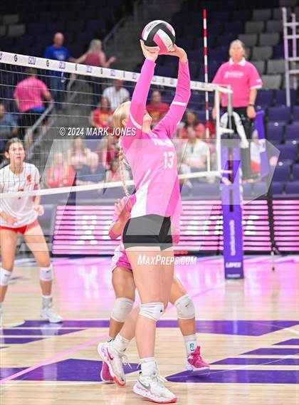 Thumbnail 2 in Seton Catholic @ Valley Christian (Dig for a Cure) photogallery.